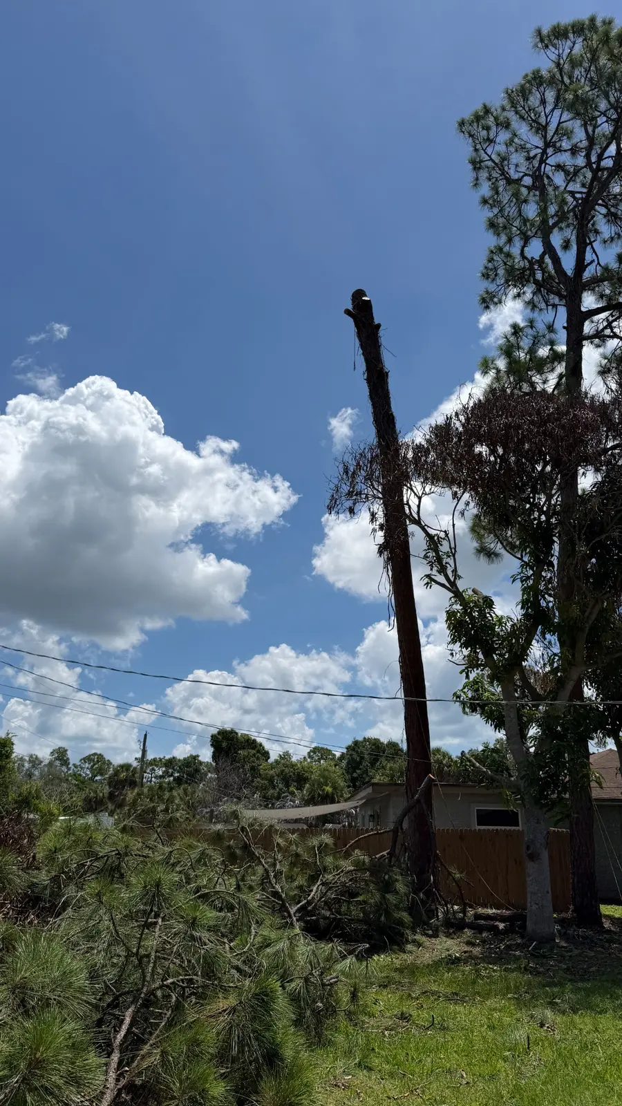 Large tree during upper limb removal